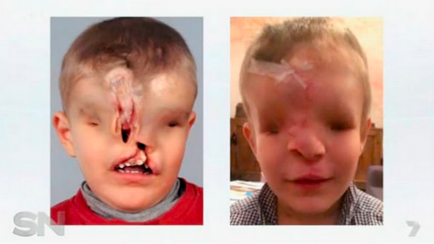 surgery-for-boy7