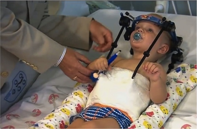 mj-godupdates-toddler-survives-miracle-surgery-after-decapitation-31