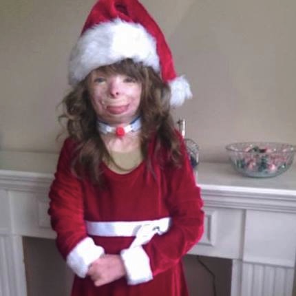 mj-godupdates-burned-orphan-wishes-for-christmas-cards-11