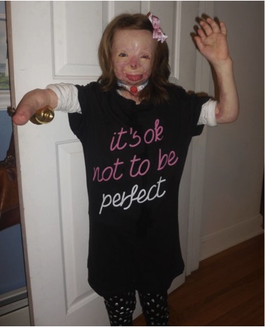 mj-godupdates-burned-orphan-wishes-for-christmas-cards-21