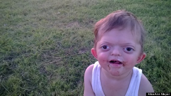 sm-gu-child-with-syndrome