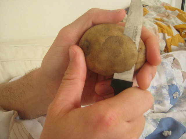 Cutting-Potato-for-Spider-Bite2