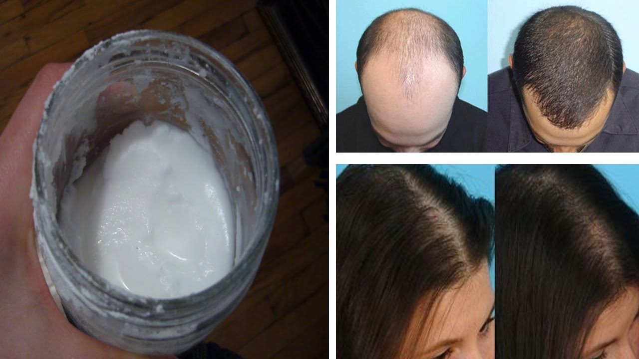 Baking Soda Shampoo Your Hair Will Grow Like It S Magic